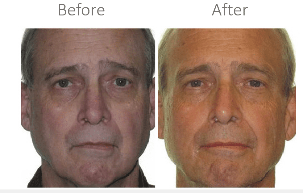 homeoblock results image