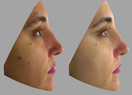 homeoblock results