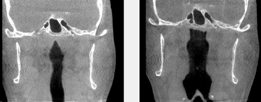 homeoblock results image
