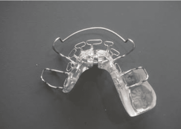homeoblock appliance image