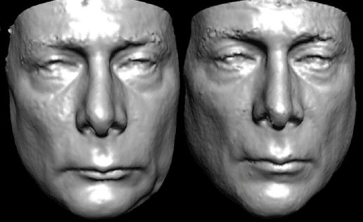 Patients Results