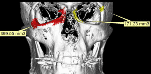Xray Results
